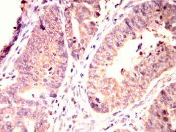 PDGFRA Antibody