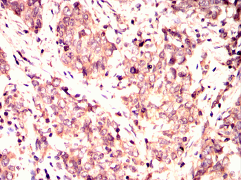 PDGFRA Antibody