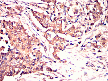 PDGFRA Antibody