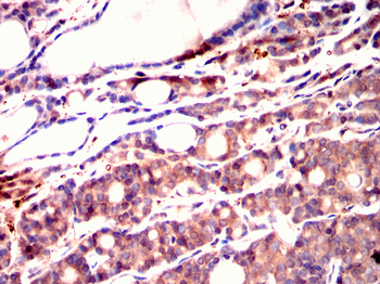 PDGFRA Antibody