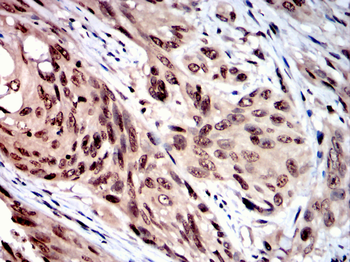 NRF1 Antibody