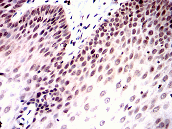 RAF1 Antibody