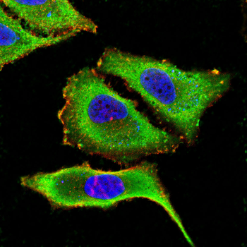 LRP5 Antibody