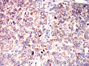 LRP5 Antibody