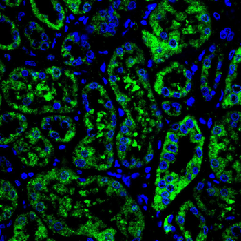 LRP5 Antibody