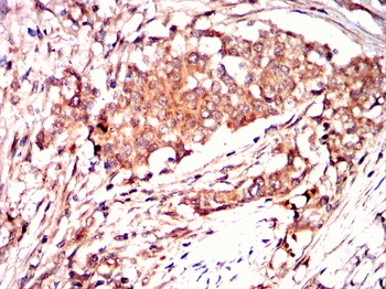 LRP5 Antibody