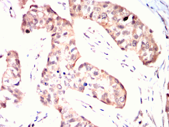 RPS6KA3 Antibody