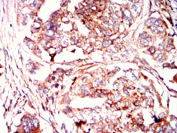 RPS6KA3 Antibody