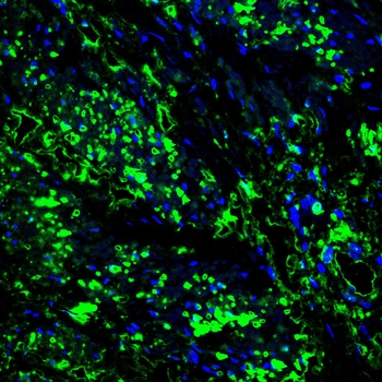 RPS6KA3 Antibody