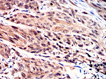 RPS6KA3 Antibody