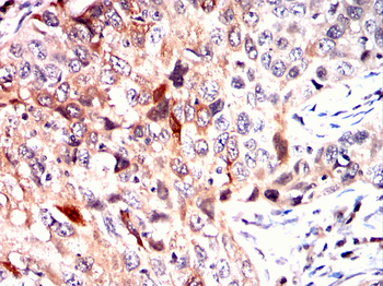 RPS6KA3 Antibody