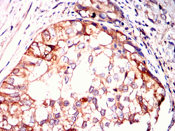RPS6KA3 Antibody