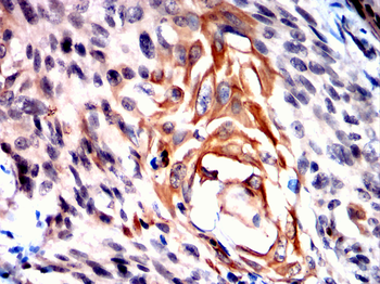HLA-G Antibody