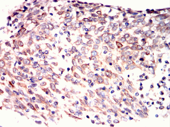 HLA-G Antibody