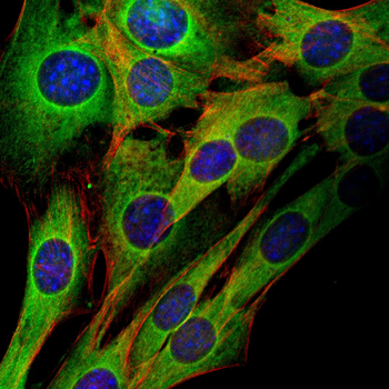 LIMS1 Antibody