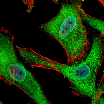 PSMB8 Antibody