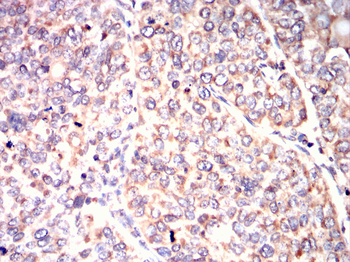 PSMB8 Antibody