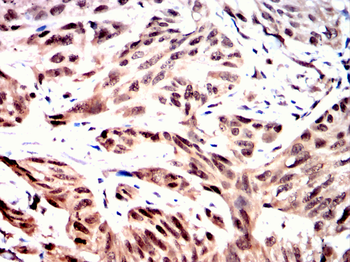 PSMB8 Antibody