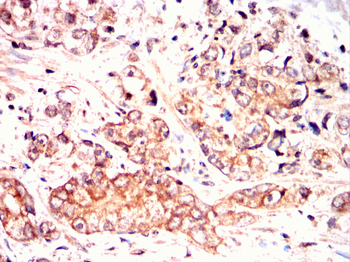 PSMB8 Antibody