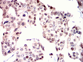 MCM2 Antibody