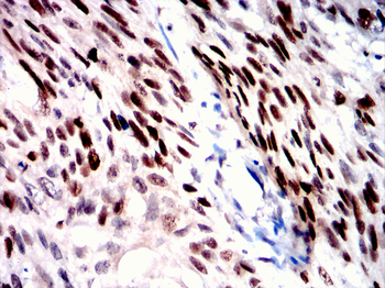 MCM2 Antibody