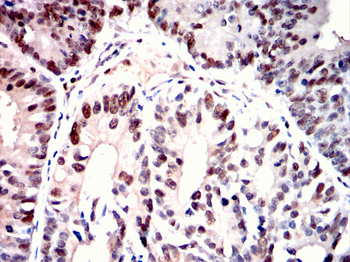 MCM2 Antibody