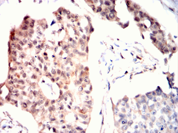 FOXP2 Antibody