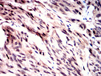 FOXP2 Antibody