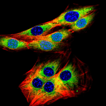 RAB20 Antibody
