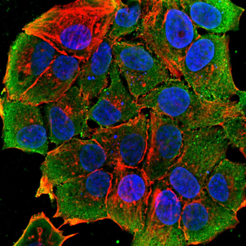 GSTM1 Antibody