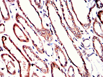 TUBA8 Antibody