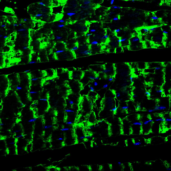 TUBA8 Antibody