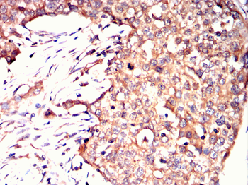 TUBA8 Antibody