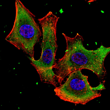 TNNI2 Antibody