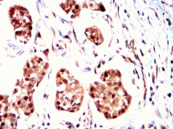 TNNI2 Antibody