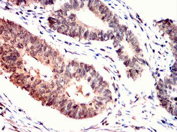 TNNI2 Antibody