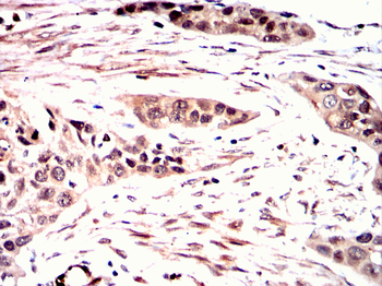 TNNI2 Antibody