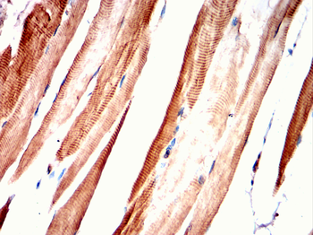 TNNI2 Antibody
