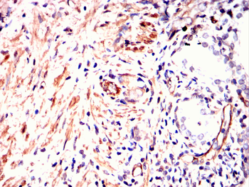 TNNI2 Antibody
