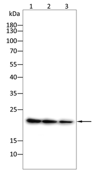 TNNI2 Antibody