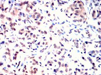 PKN2 Antibody