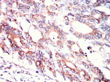 MSN Antibody