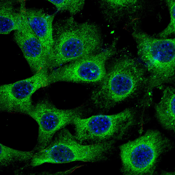 PPM1A Antibody