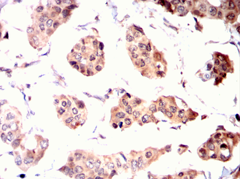 PPM1A Antibody