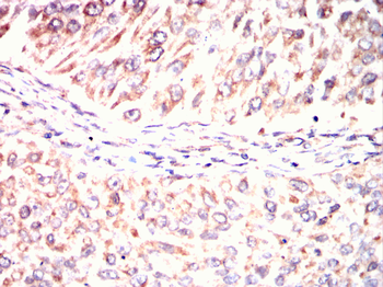 PPM1A Antibody