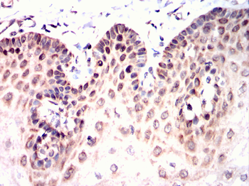 PPM1A Antibody