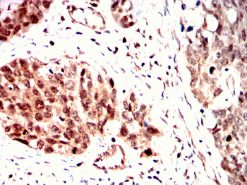 PPM1A Antibody