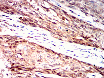PPM1A Antibody