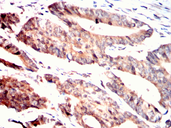 PPM1A Antibody
