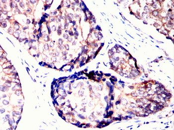 PPM1A Antibody